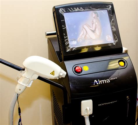 alma laser hair removal locations